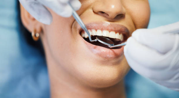 Best Knocked-Out Tooth Emergency  in Wellington, OH